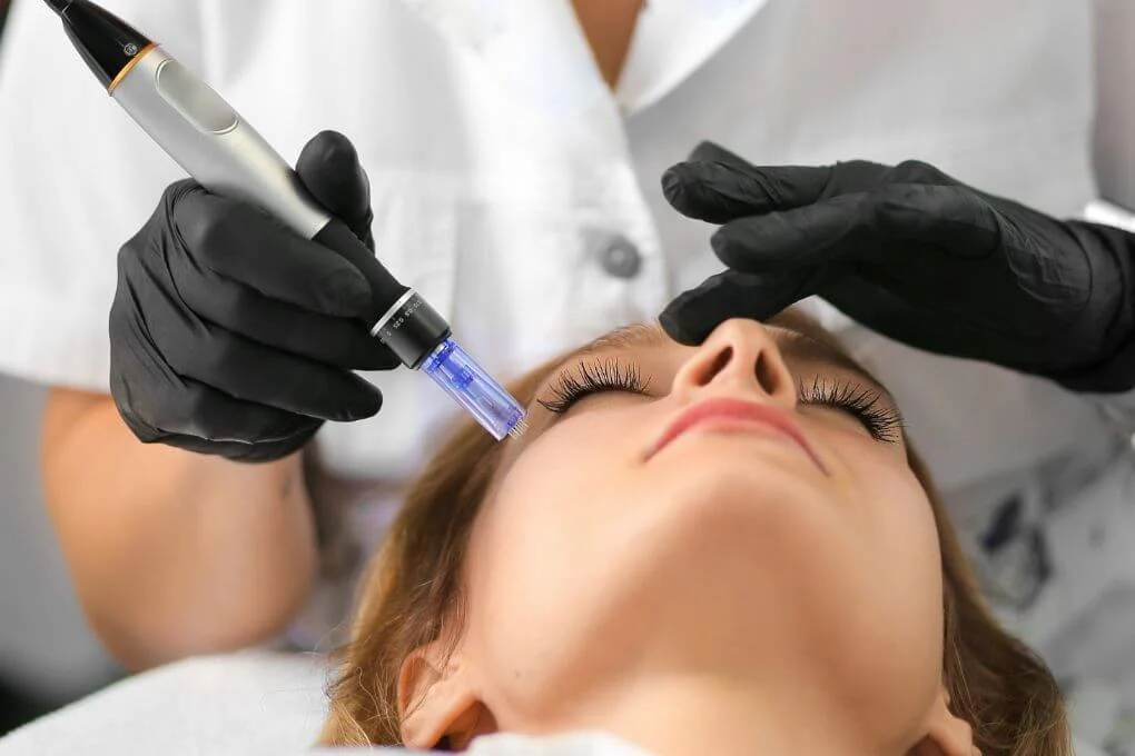 Microneedling Basis Opleiding bij de Schoonheidsacademie