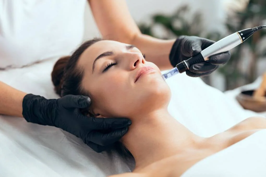 Microneedling Medisch Opleiding bij de Schoonheidsacademie